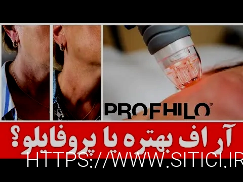 آر اف بهتر است یا هایفو